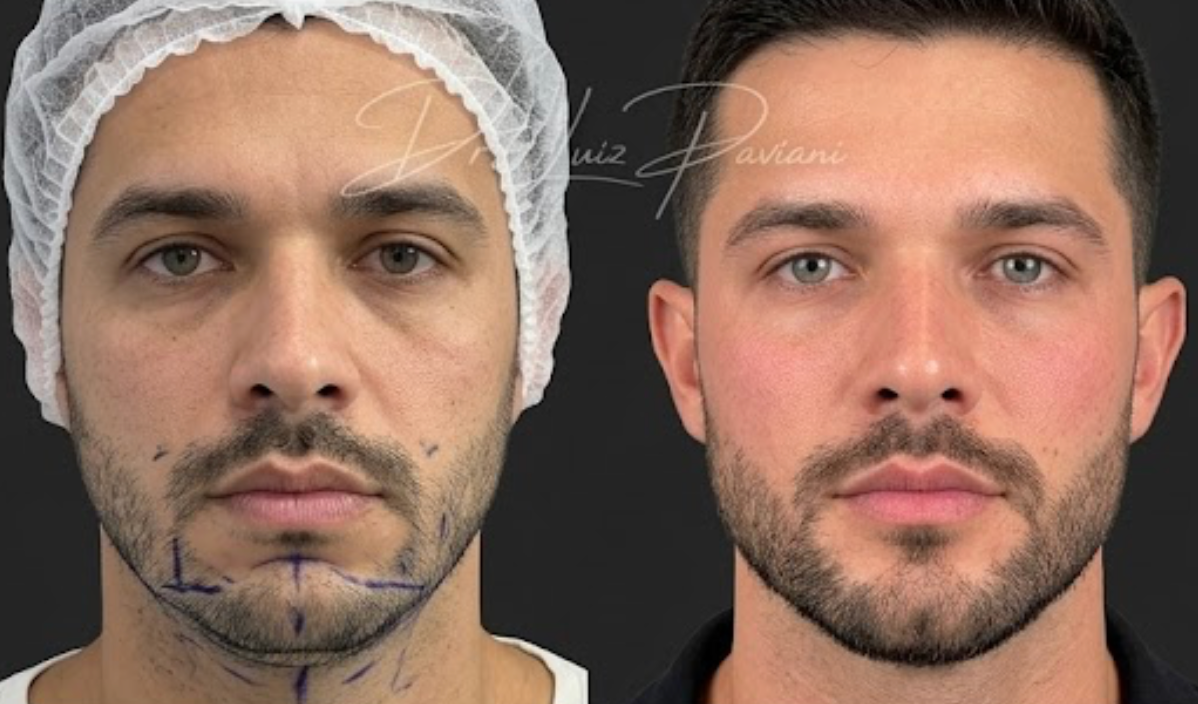 Antes e Depois 1