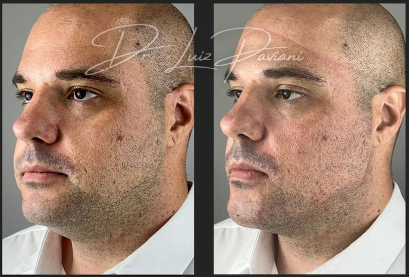 Antes e Depois 2